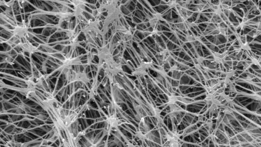 EPTFE��ˮ͸��Ĥ